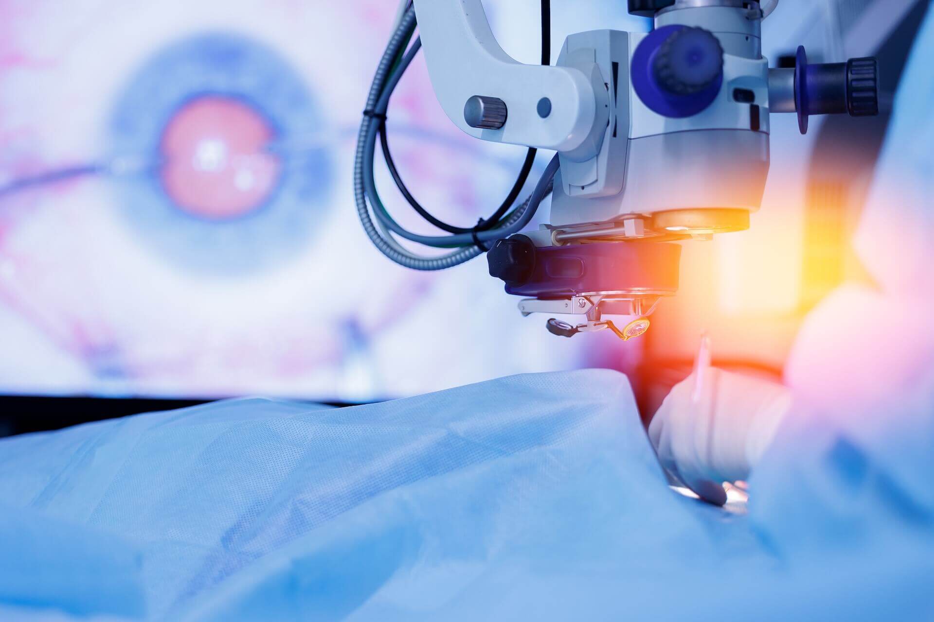 Augenlaser Gerät in Verwendung